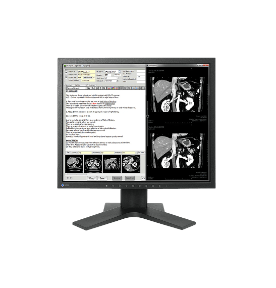 MX194