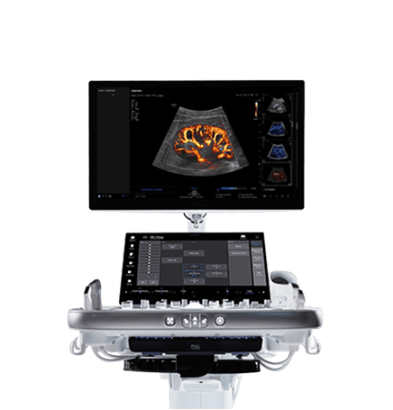 Samsung Ultrasound